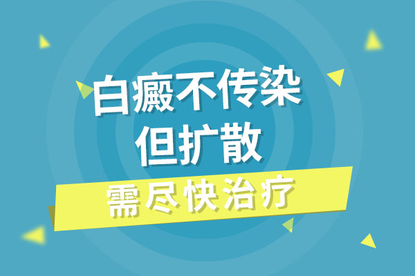 白癜风会不会传染到别人的身上?